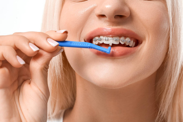 Giovane donna con apparecchio dentale e spazzolino da denti su sfondo bianco - Foto, immagini