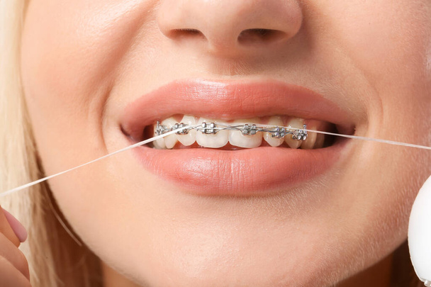 Giovane donna con apparecchio dentale e filo interdentale, primo piano - Foto, immagini
