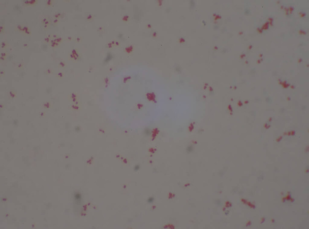 Bacterias diplococos gramnegativas Neisseria spp.Antecedentes médicos. - Foto, imagen