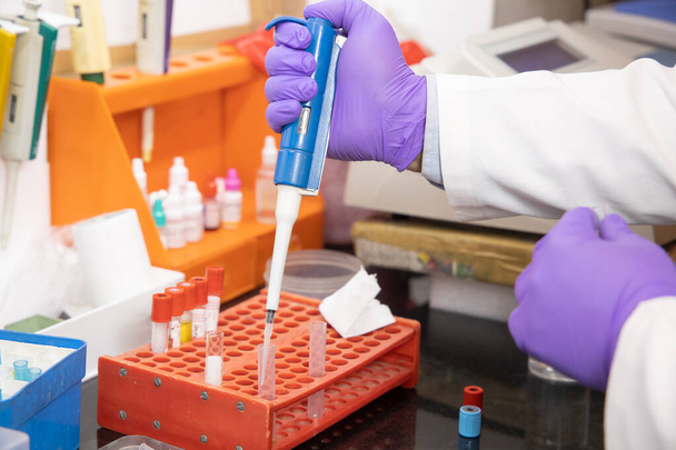 Detailní záběr rukou v modrých rukavicích s pipetou a zkumavkou provádějící chemický nebo farmaceutický výzkum v klinické laboratoři, vědec nebo lékař provádějící analýzu covid virové vakcíny, zdravotní péče a pademie - Fotografie, Obrázek