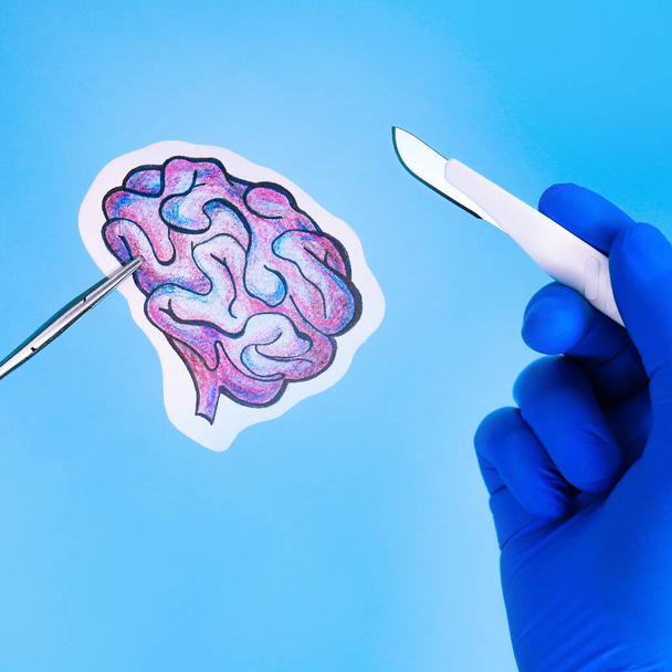 екстрена хірургія на людському мозку. малюнок олівцем
. - Фото, зображення