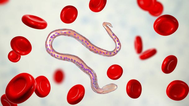 Wuchereria bancrofti, een rondworm nematode, een van de oorzaken van lymfatische filariasis, 3D illustratie waaruit blijkt dat de aanwezigheid van omhulsel rond de worm en staart kernen niet uitstrekken tot tip - Foto, afbeelding