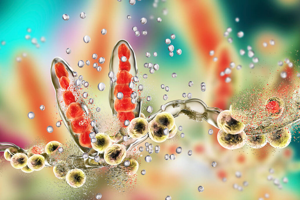 Destruction of fungus Trichophyton by silver nanoparticles, a fungus which causes athlete's foot Tinea pedis and scalp ringworm Tinea capitus. 3D illustration. Concept for antifungal treatment - Photo, Image