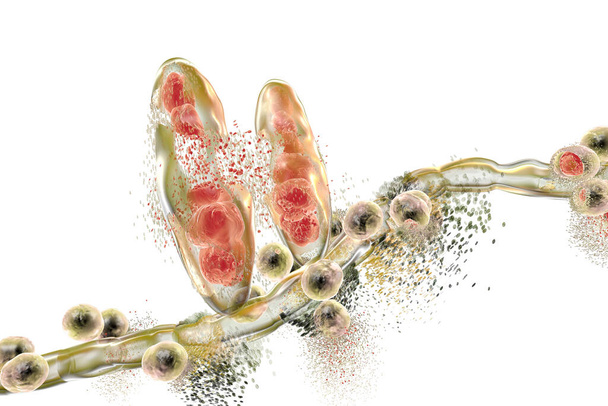 Vernietiging van schimmel Trichophyton mentagrophytes die ervoor zorgt dat atleet voet Tinea pedis en hoofdhuid ringworm Tinea capitus. 3D illustratie. Concept voor schimmelwerende behandeling - Foto, afbeelding