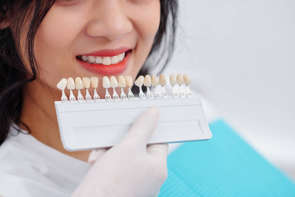 Γκρο πλαν εικόνα του οδοντιάτρου χρησιμοποιώντας παλέτα κατά την επιλογή του χρώματος των δοντιών των γυναικών ασθενών πριν από τη διαδικασία λεύκανσης - Φωτογραφία, εικόνα