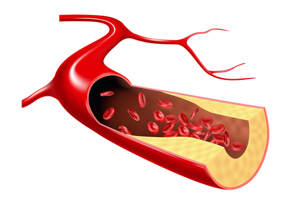 Χοληστερόλη και ερυθροκύτταρα ρέουν στη φλέβα. 3D εικονογράφηση - Φωτογραφία, εικόνα