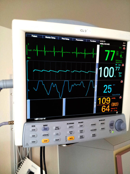 Écran de moniteur d'EKG, d'impulsion, de tension et de respiration ICU - Photo, image