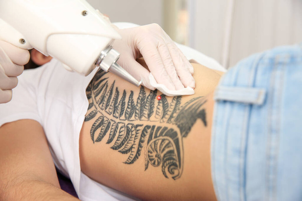 Young woman undergoing laser tattoo removal procedure in salon, closeup - Foto, Imagem