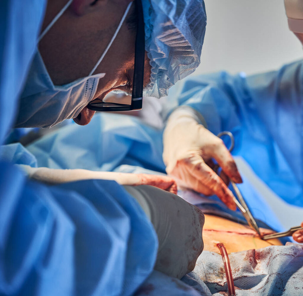 手術室でおなかタック手術を行う滅菌手袋の外科チームの閉鎖。整形外科医と腹部形成外科の助手。腹部形成術、美容整形の概念. - 写真・画像