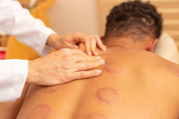 Detalle de manos del terapeuta dando masaje de espalda al paciente con marcas de ventosa. - Foto, imagen