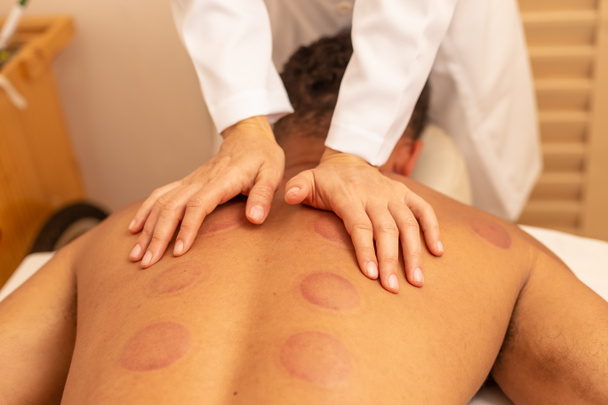 Détail des mains du thérapeute donnant massage dos au patient avec des marques de ventouse. - Photo, image
