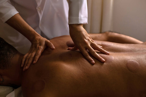 Detail der Hände des Therapeuten, der dem Patienten mit Saugnapf eine Rückenmassage gibt. - Foto, Bild