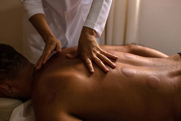 Détail des mains du thérapeute donnant massage dos au patient avec des marques de ventouse. - Photo, image