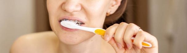 Κορίτσι με σιδεράκια στα δόντια να βουρτσίζει τα δόντια της με οδοντόβουρτσα, κοντινό πλάνο. Οδοντιατρική και στοματική φροντίδα. Ιμάντες για την ανύψωση των δοντιών - Φωτογραφία, εικόνα