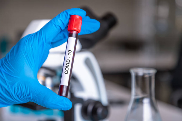 Исследователь или медицинский техник, держащий пробирку, содержит образец крови с инфекцией COVID-19 в лаборатории для проведения исследований по обнаружению вакцины - Фото, изображение