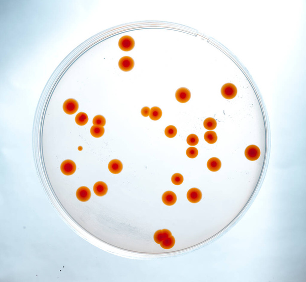 a laboratóriumban elhelyezett baktériumok képe egy tartályban - Fotó, kép