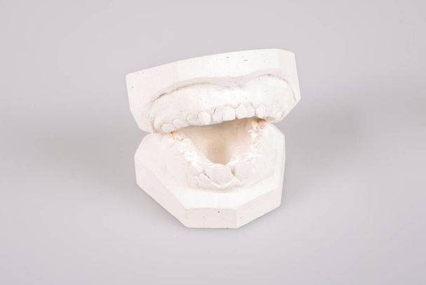 Fabrication d'implants dentaires imprimer des dents en plâtre laboratoire dentaire - Photo, image