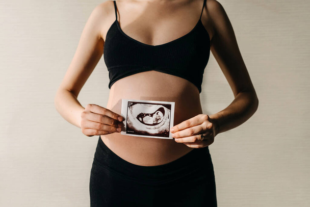 Schwangere mit Baby-Ultraschallbild vor dem Bauch. - Foto, Bild