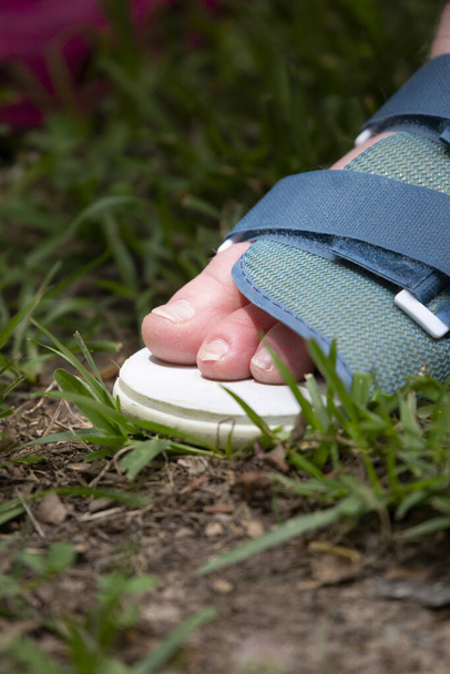 Mulher usando um sapato para um pé quebrado - Foto, Imagem