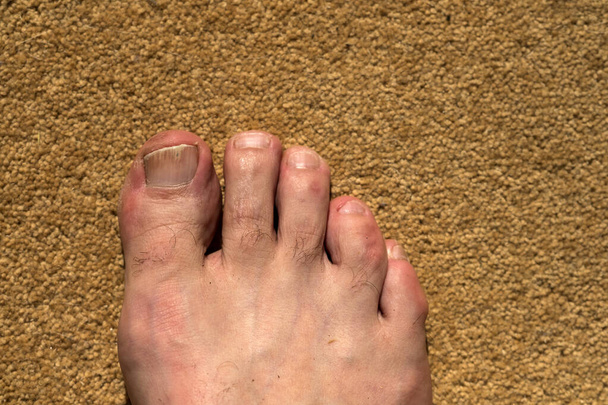 Δάχτυλα στο δεξί πόδι ενός ενήλικου λευκού άντρα - Φωτογραφία, εικόνα