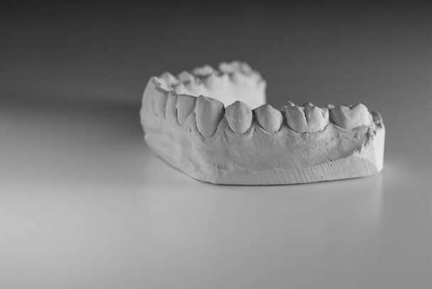 Ortodontia. Cópia de gesso da mandíbula de uma pessoa. Conceito de saúde bucal - Foto, Imagem