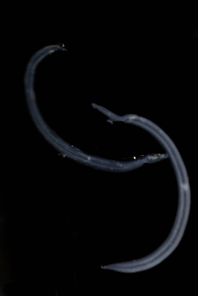 Schistosoma es un género de trematodos, comúnmente conocido como grietas sanguíneas bajo el microscopio para educación en laboratorio.. - Foto, imagen