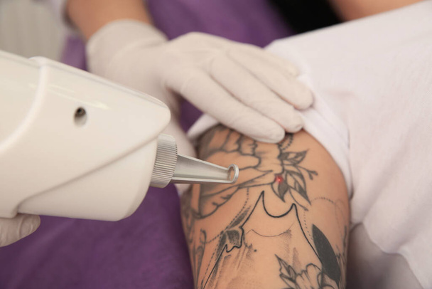 Young woman undergoing laser tattoo removal procedure in salon, closeup - Zdjęcie, obraz