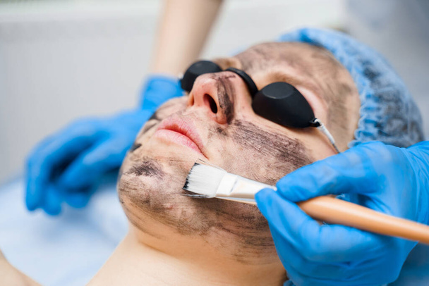 Δερματολόγος μουτζουρώνει μαύρη μάσκα στο πρόσωπο για φωτορεπορτάζ λέιζερ και ξεφλούδισμα άνθρακα. Δερματολογία και κοσμετολογία. Χρήση χειρουργικού λέιζερ. - Φωτογραφία, εικόνα