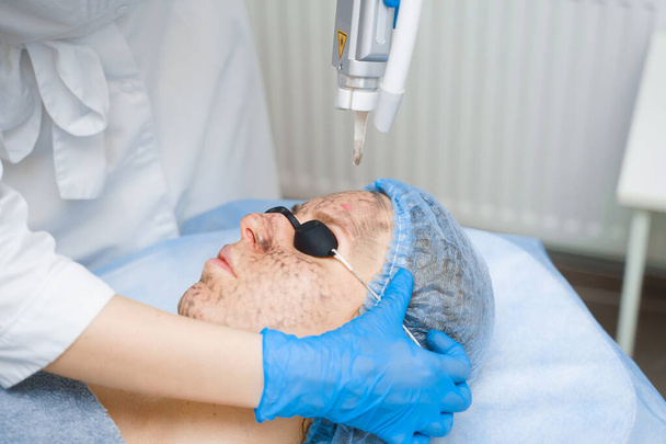 Laserfotorejuvenation und Carbon-Peeling des Gesichts für die Frau. Schwarze Gesichtsmaske. Dermatologie und Kosmetologie. Chirurgischer Laser. - Foto, Bild