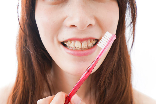 Молодая женщина с ортодонтическими брекетами - Фото, изображение