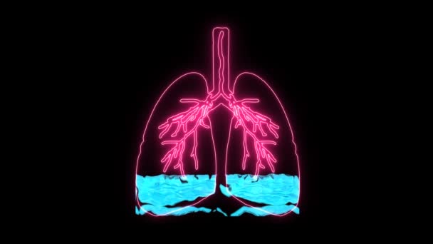 Pulmonary Edema in holographic is a condition caused by abnormal fluid in the alveoli. Resulting in patients with difficulty breathing or lack of breath due to lack of oxygen - Footage, Video