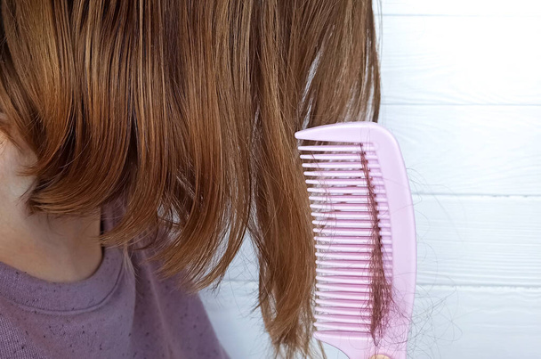 Проблема с выпадением волос. Женщина держит розовую расческу. - Фото, изображение
