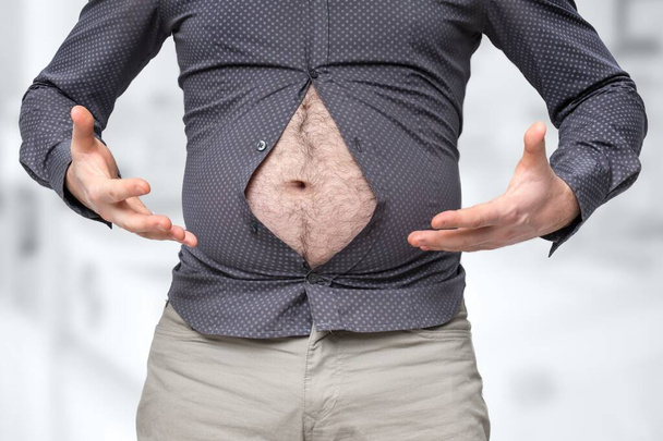 Ihmisen lihava vatsa, joka ei mahdu paidan alle - lihavuuden käsite - Valokuva, kuva