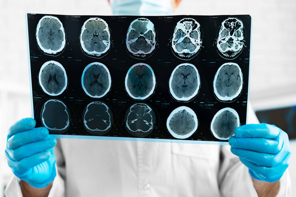 Hands of a doctor holding head mri scan - Фото, изображение