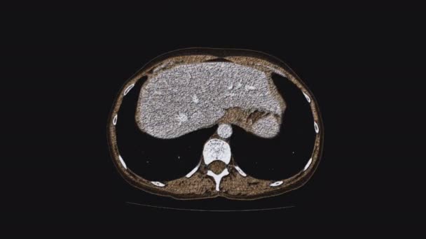 Objętościowy kolor MRI żeńskich narządów miednicy, jamy brzusznej, przewodu pokarmowego i pęcherza moczowego - Materiał filmowy, wideo