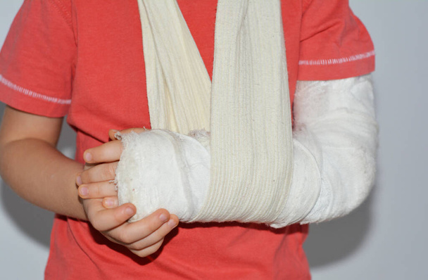 Primo piano di un bambino, un bambino di quattro anni con un braccio rotto in un gesso per l'immobilizzazione di un osso rotto. - Foto, immagini