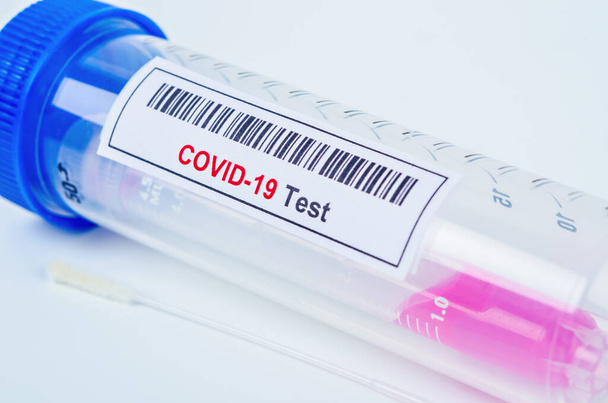 Tube containing nasopharyngeal swab for coronavirus or COVID-19 test in laboratory. - Photo, Image