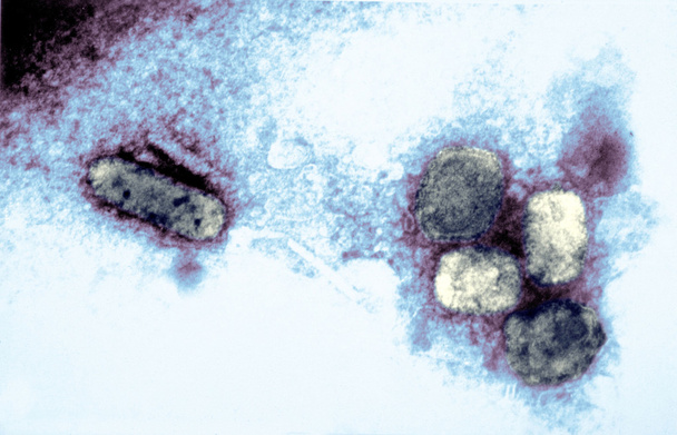 Smallpox virus - Photo, Image