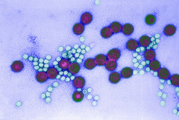 gastroenteritida virus - Fotografie, Obrázek