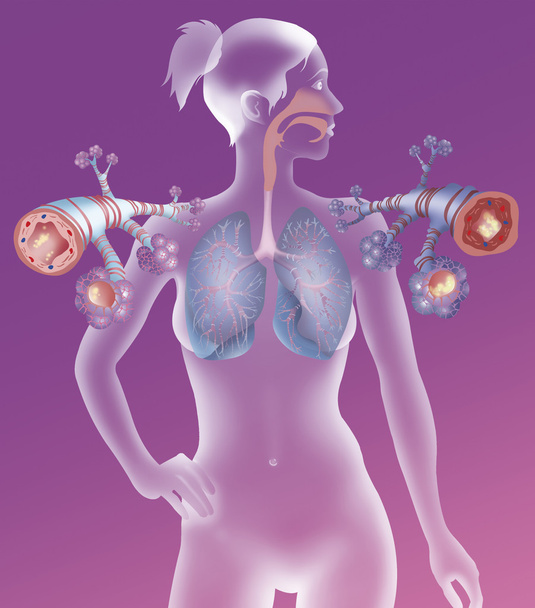 Representación de un tubo bronquial sano
 - Foto, imagen