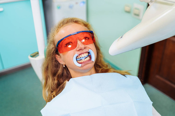Λεύκανση δοντιών. Ένας ασθενής με προστατευτικά γυαλιά από τις ακτίνες στην καρέκλα του οδοντιάτρου. Προληπτική εξέταση της στοματικής κοιλότητας. Τοποθέτηση του διαχωριστή στόματος. Στο ραντεβού με τον οδοντίατρο. - Φωτογραφία, εικόνα