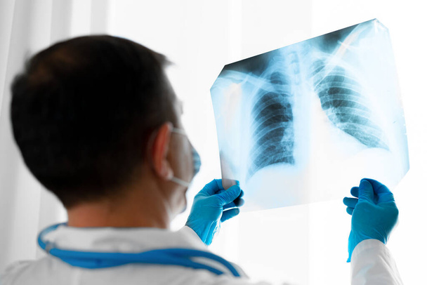 Doctor examining lungs x-ray scan in his office in hospital - 写真・画像