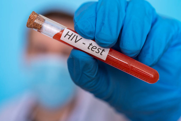 Un tubo de prueba con sangre para una prueba del VIH es sostenido por la mano de un médico con guantes médicos. Concepto de investigación y desarrollo para el control de enfermedades. - Foto, Imagen