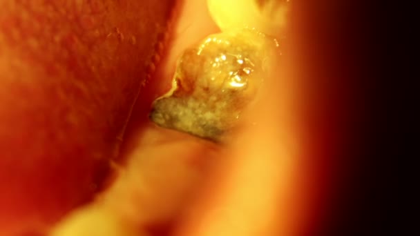 Hohlräume und kaputte Zähne sind schmerzhaft - Filmmaterial, Video
