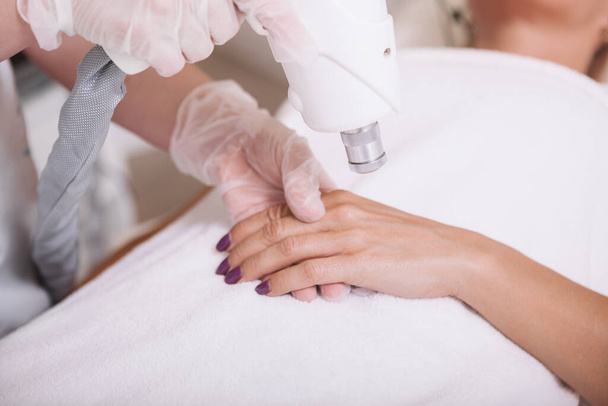 Обрезаны крупным планом зрелой женщины, удаляющей пигментацию кожи на руках, дерматолог использует лазер - Фото, изображение
