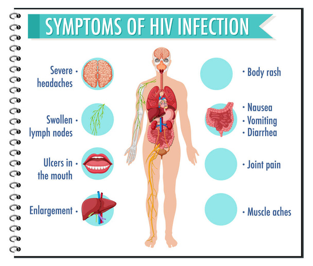 Τα συμπτώματα της λοίμωξης HIV infographic εικόνα - Διάνυσμα, εικόνα
