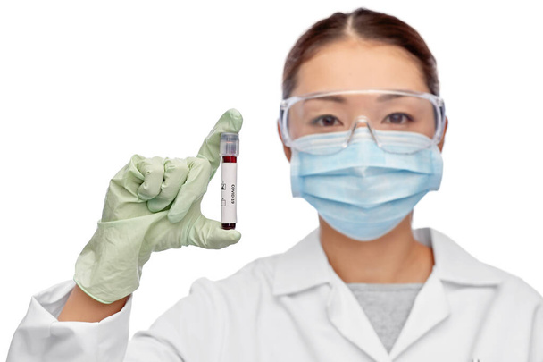 asian female doctor holding beaker with blood test - 写真・画像