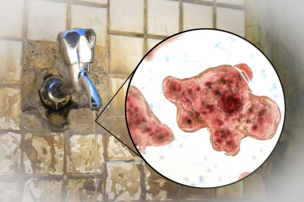 Brain-eating amoeba awareness concept. 3D illustration showing potential way of aquiring infection during ritual nasal rinsing. Trophozites of Naegleria fowleri can be present in dirty tap water - Photo, Image