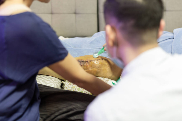 Médecin nettoyer le genou du patient après la chirurgie avec de l'alcool - Photo, image
