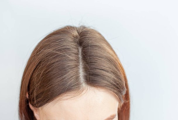 Une tête de femme avec une séparation de cheveux gris.  - Photo, image